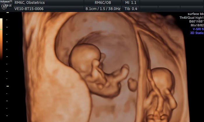 Mundo Bebé especialista en ecografía 5D prenatal