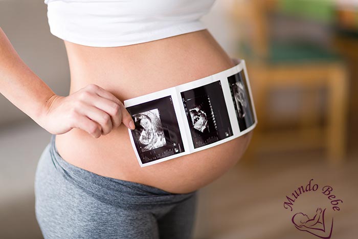 Mundo Bebé especialista en ecografía 5D prenatal