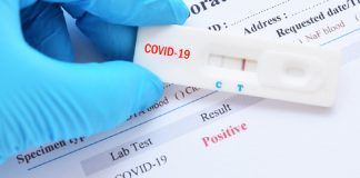 El Ayuntamiento de Alcorcón lleva días gestionando test de COVID-19 para personal municipal