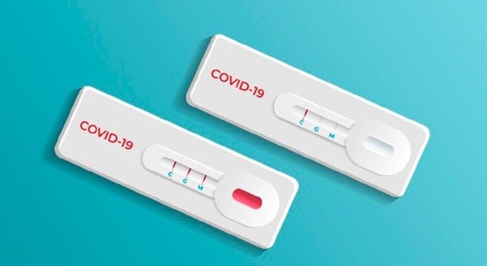 Los resultados de antígenos arrojan 19 positivos entre más de 7.000 test realizados. Solo el 29% de los citados en Alcorcón se han hecho los test.