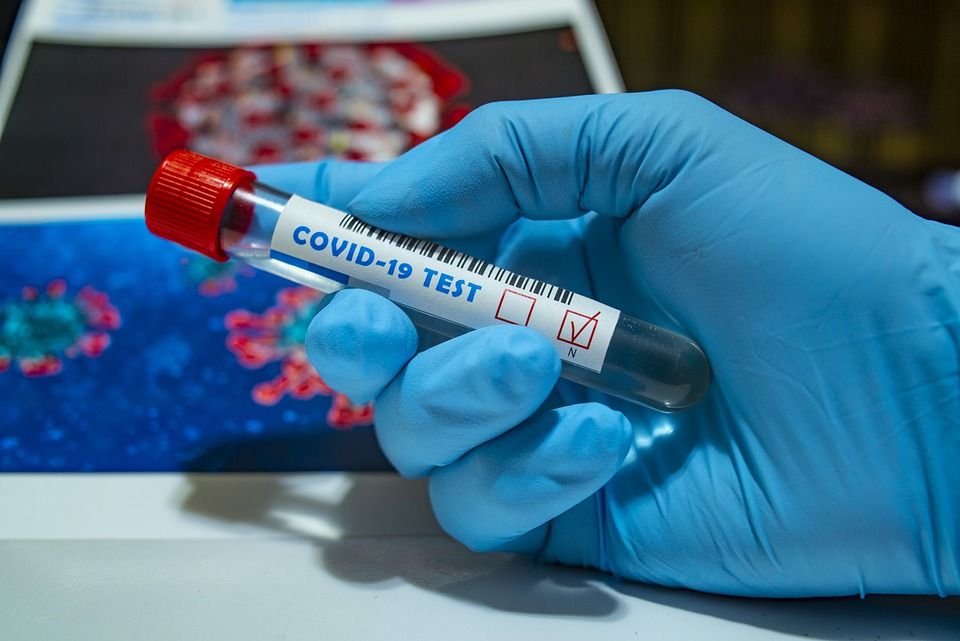 El 11 de febrero test de antígenos en la ZBS de La Ribota en Alcorcón