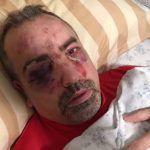 paliza-calle-alcorcon