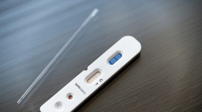 Bajada de los precios de los test de Covid-19 en Alcorcón y toda España Bajada de los precios de los test de Covid-19 en Alcorcón y toda España