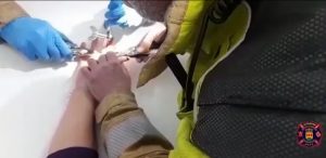 Los bomberos de Alcorcón retiran un anillo atrapado en la mano de una mujer
