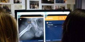 El Hospital de Alcorcón incorpora herramientas por inteligencia artifical para diagnóstico por imagen