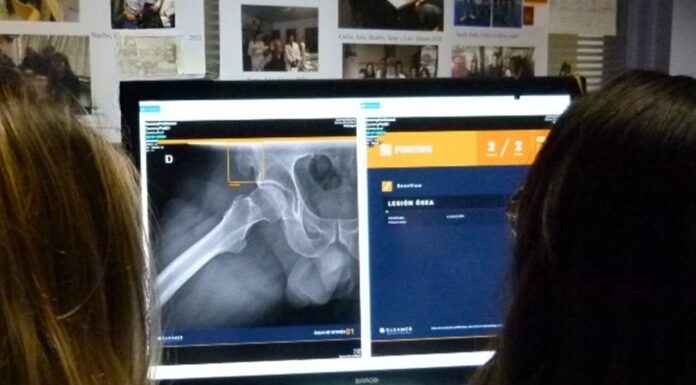 El Hospital de Alcorcón incorpora herramientas por inteligencia artifical para diagnóstico por imagen